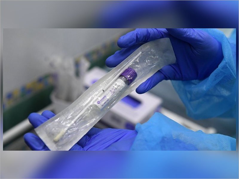 Тест на коронавирусную инфекцию в России можно сделать в 438 лабораториях