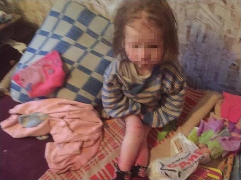 В Брянске приёмные родители морили голодом 7-летнего ребенка. К расследованию подключилась прокуратура
