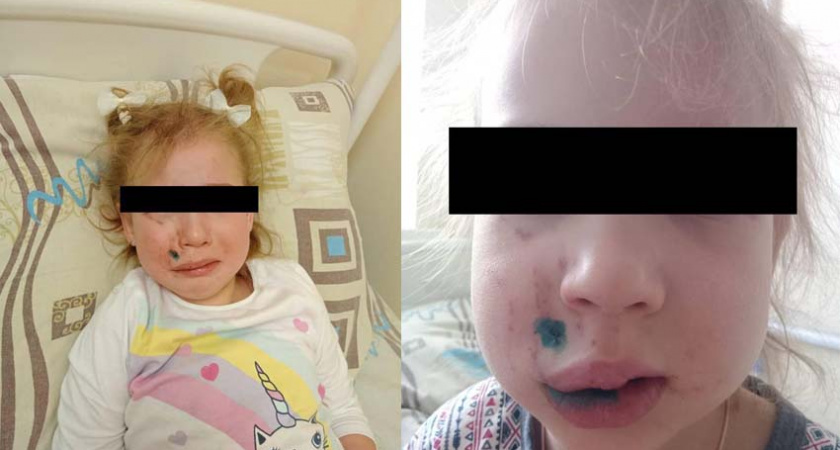 ЧП в брянском кафе: огромная кане-корсо напала на 4-летнюю девочку