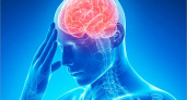 Всемирный день борьбы с инсультом: к 2030 году смертность от инсульта может составить 7 млн. человек в год