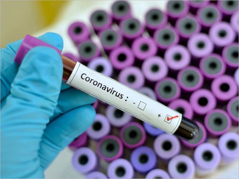Количество коронавирусных больных в Брянской области упало ниже 170 человек