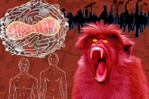Вирусолог Петр Лидский: Почему не стоит бояться обезьяньей оспы
