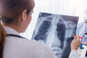 Заболеваемость туберкулёзом в Брянской области за пять лет снизилась в 1,6 раза, смертность — в два раза