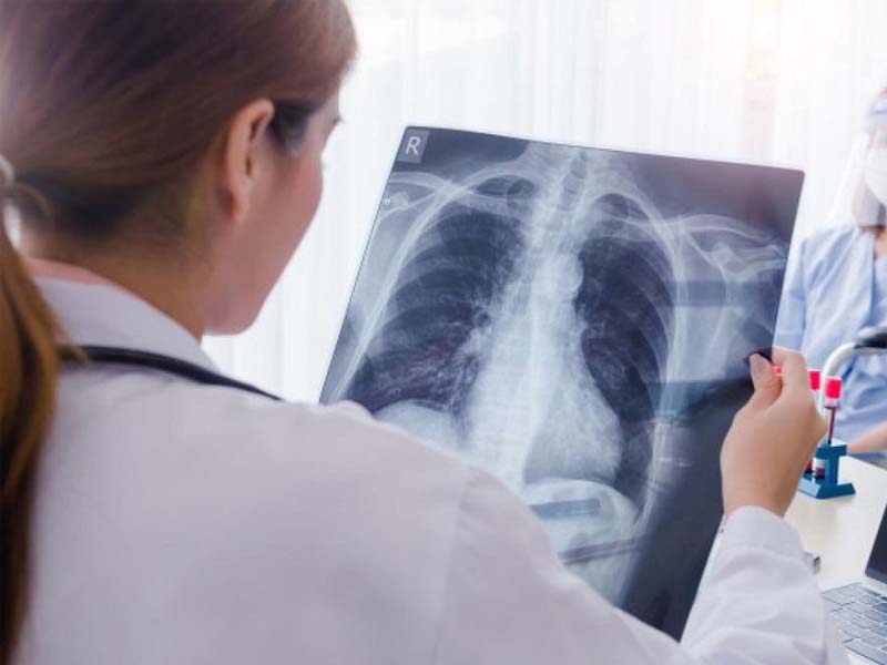 Заболеваемость туберкулёзом в Брянской области за пять лет снизилась в 1,6 раза, смертность — в два раза