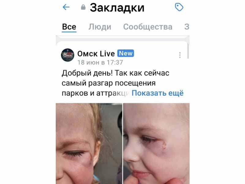 Власти Брянска опровергли информацию о пострадавшей на аттракционе девочке