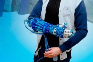 Сеченовский университет разработал перчатку для борьбы со спастикой кистей рук